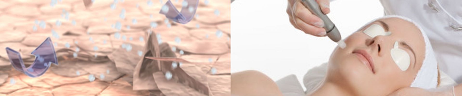 Mikrodermabrasion Ionto Comed® Ludwigsburg | Stuttgart