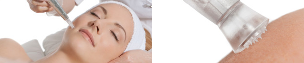 Microneedling Behandlung für eine strahlend schöne Haut ABSOLUT BEAUTY